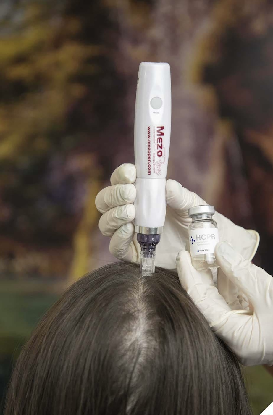 Mezoterápiás hajkezelés